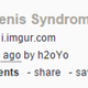 Image for article titled Rust Randomizes Penis Length, Players Compare Sizes